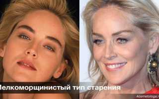 Старение лица