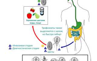 Как лечится лямблиоз у детей