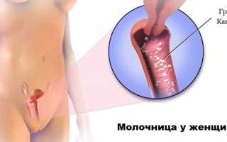 Высыпания при молочнице у женщин