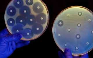 Стафилококк aureus что это
