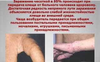 Чесотка на лице у ребенка