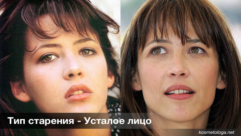 Старение лица