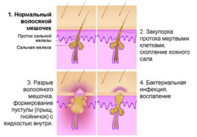 выпадение волос если болит кожа головы
