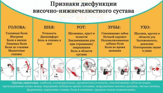 Признаки дисфункции ВНЧС