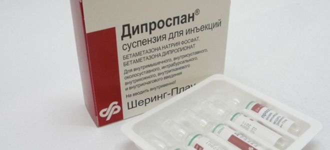 инъекции от боли в спине инъекции от боли в спине