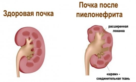 Почему может болеть низ спины у женщин