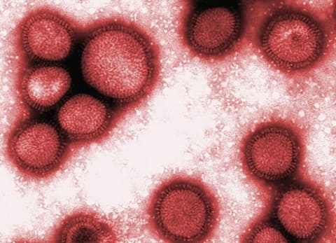 Вирус свиного гриппа А(H1N1)