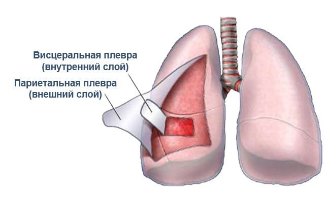 Такие плевральные мешки защищают легкие от воспалений и других патологических факторов. Если они воспаляются сами, такое заболевание называется плеврит