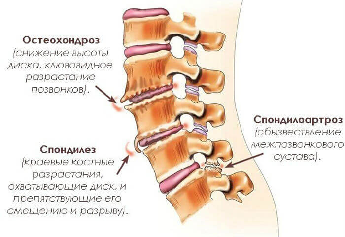 spondelez